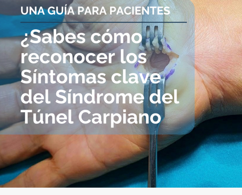 Síntomas del Síndrome del tunel carpiano por Institut de la Mà