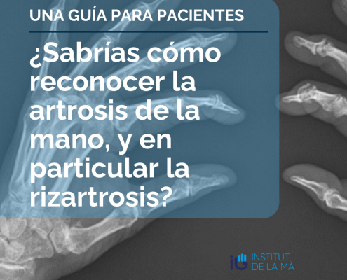 Cómo reconocer la artrosis de la mano y la rizartrosis por Institut de la Mà